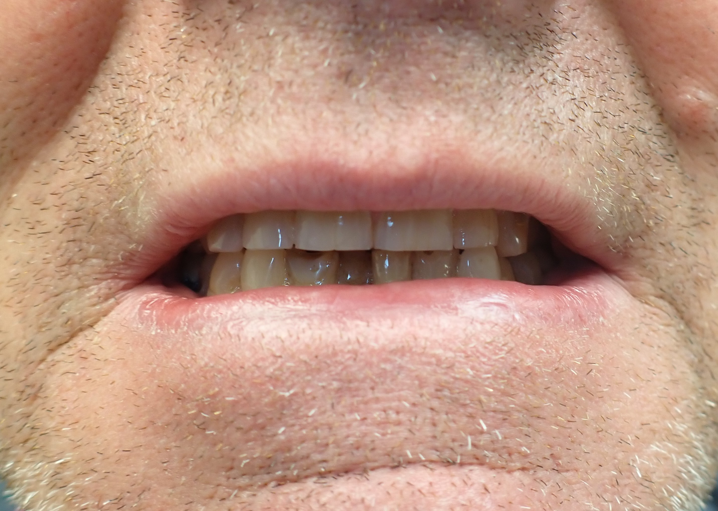 Close up of mouth with damaged teeth