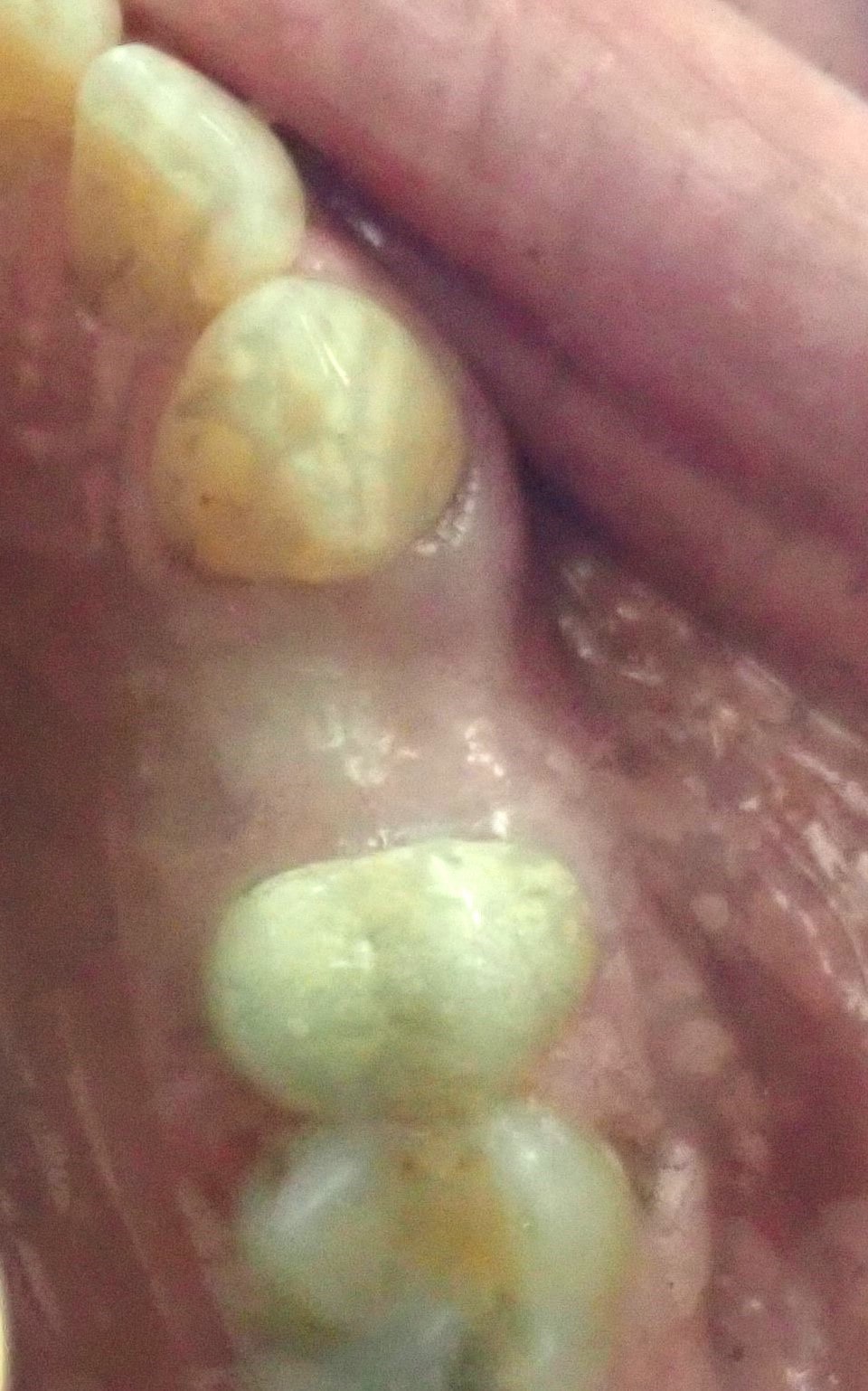 Close up of gap between teeth