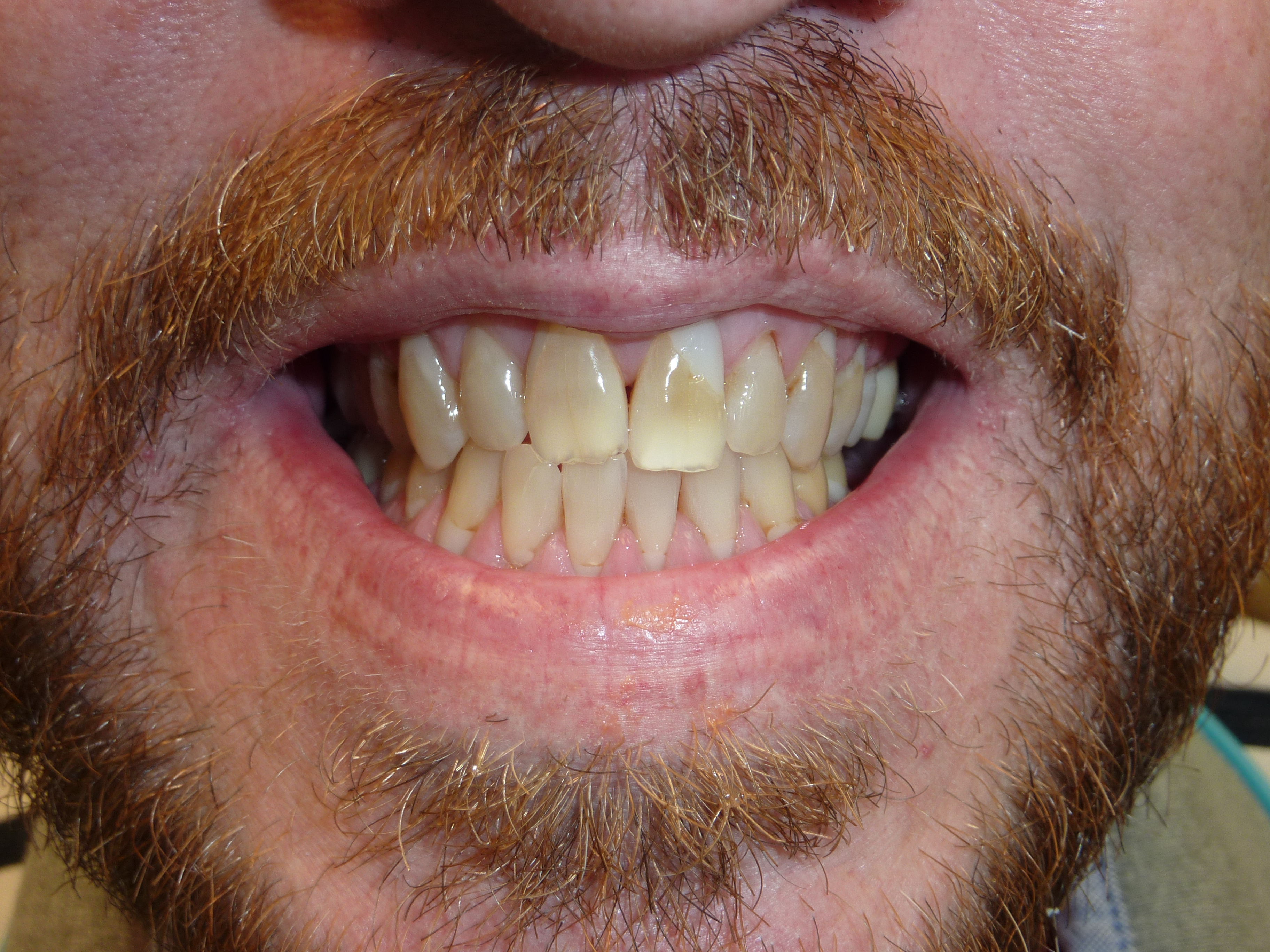 Close up of multiple colored teeth