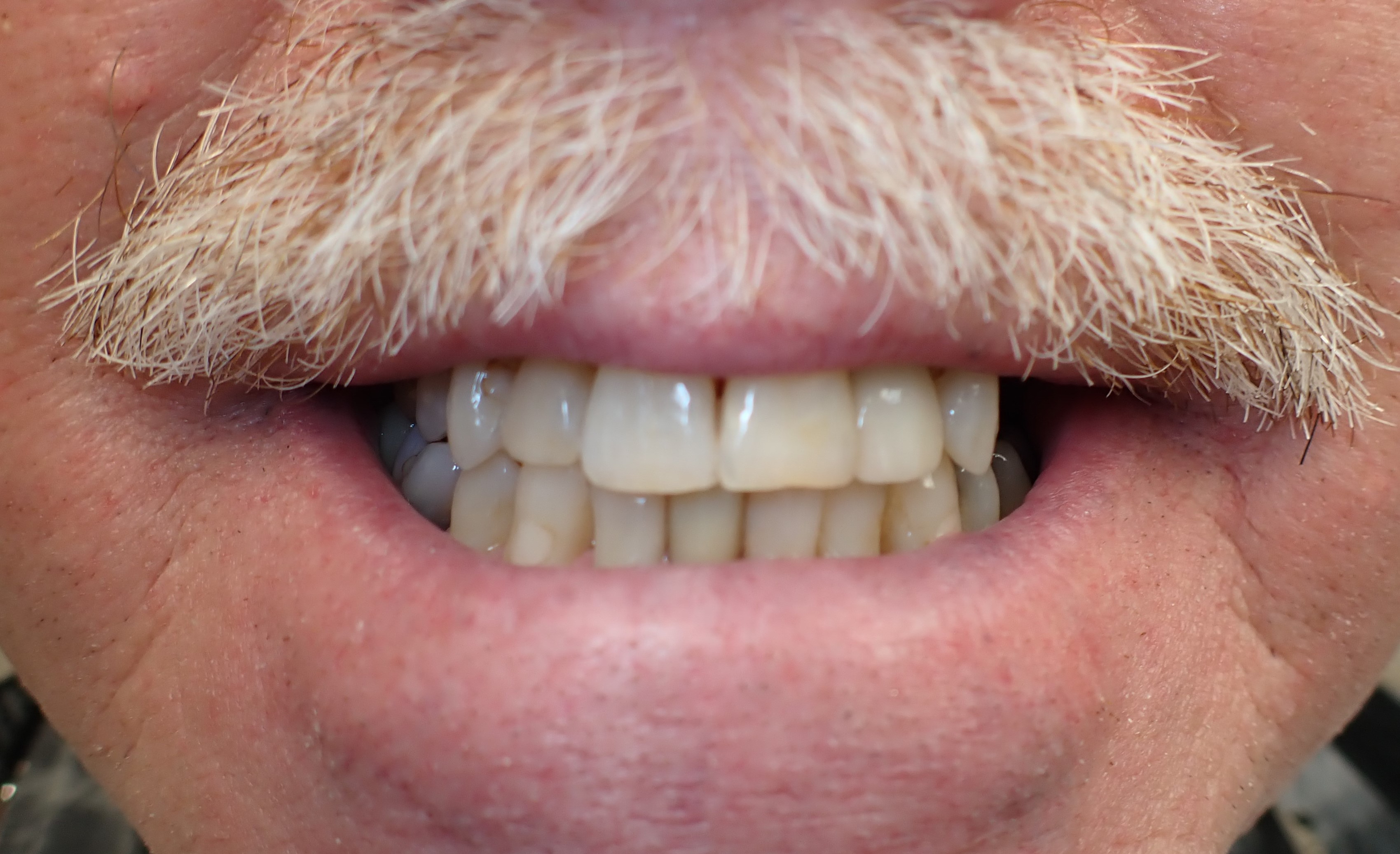 Close up of mustached man smiling