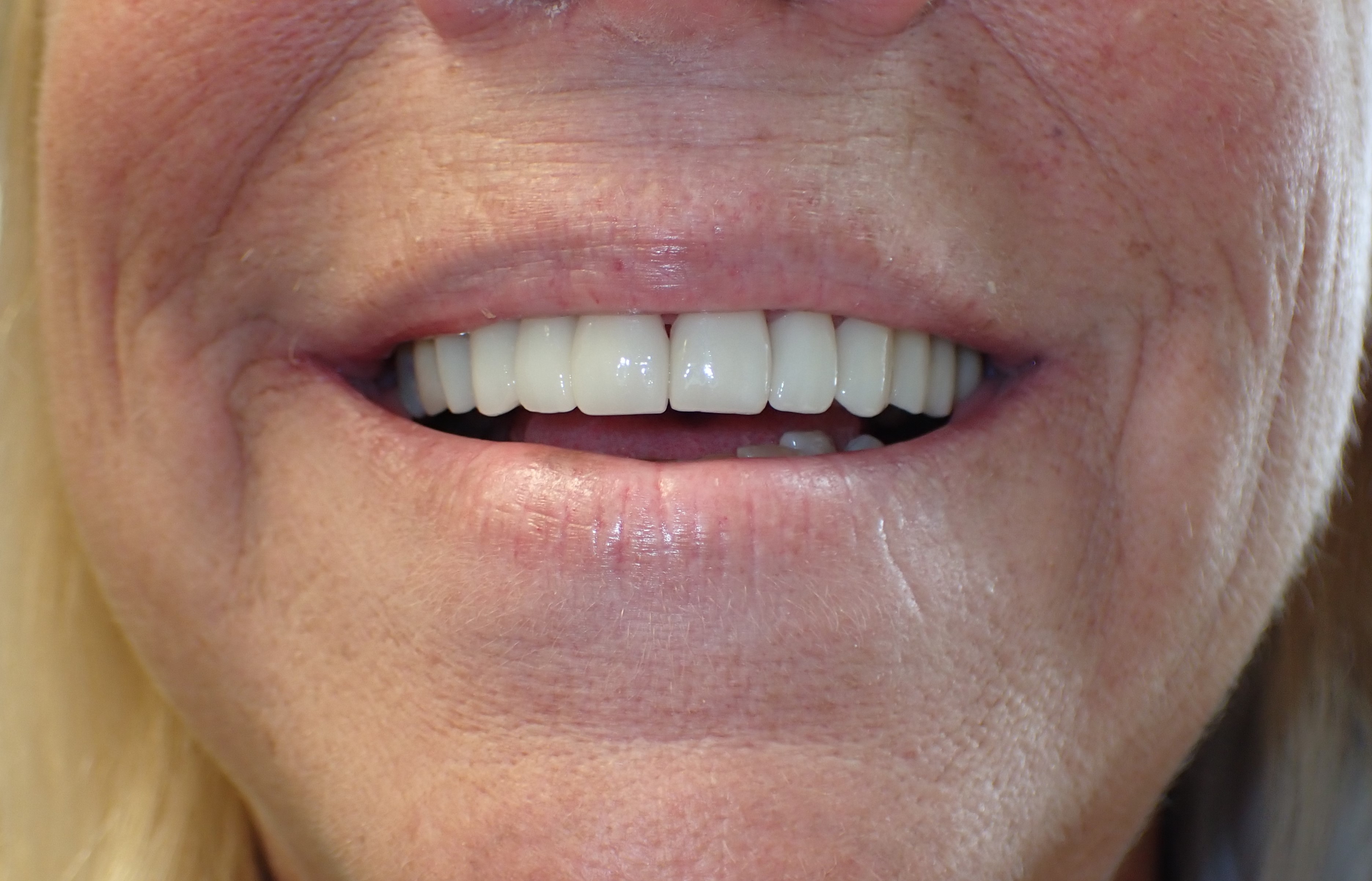 Man showing improved teeth after smile makeover