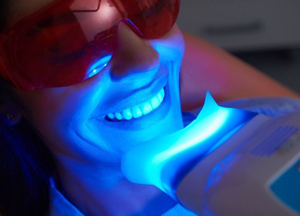 woman undergoing in office whitening 